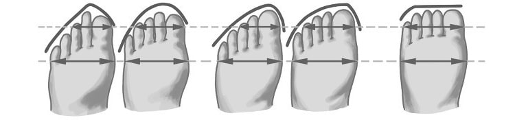Die verschiedenen Fußformen